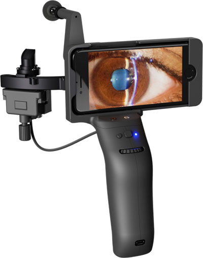 Anterior Segment Evaluation (Portable Slit Lamp – PSL D20)