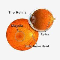 Retina Treatment in Mumbai, Bandra, Kandivali